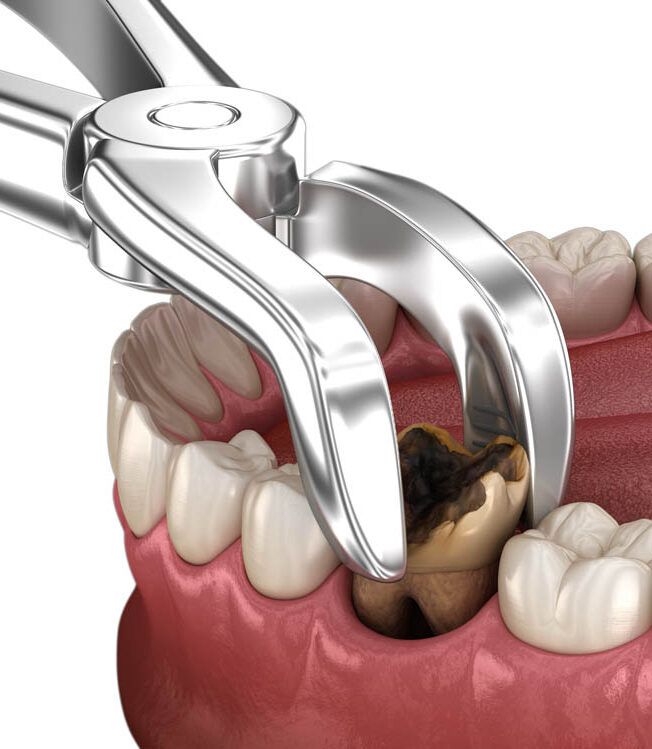 Chirurgia dentale
